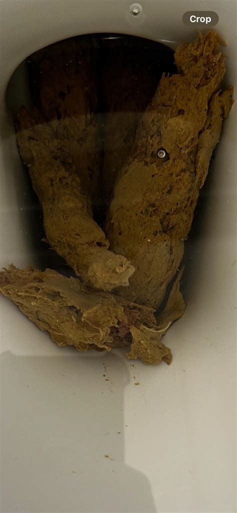 5 Ways Biofilm Affects Stool