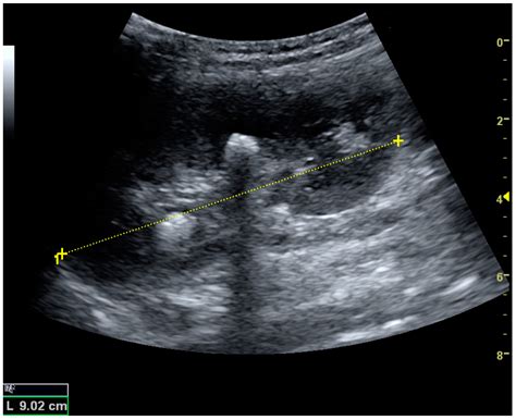 Diagnostics Free Full Text Ultrasonography Of The Kidney A Diagnostics Free Full Text Ultrasonography Of The Kidney A