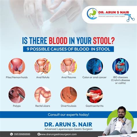 How Blood Affects Stool Health Dr Arun S Nair Surgical Gastroenterologist Advanced How Blood Affects Stool Health Dr Arun S Nair Surgical Gastroenterologist Advanced