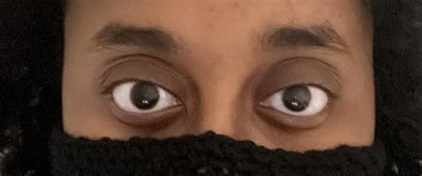 How Can I Use Makeup To Reduce My Upper Eyelid Exposure It S Getting On My Nerves R Makeupaddiction How Can I Use Makeup To Reduce My Upper Eyelid Exposure It S Getting On My Nerves R Makeupaddiction