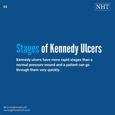 5 Kennedy Ulcer Pictures